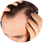 man's head with hair loss