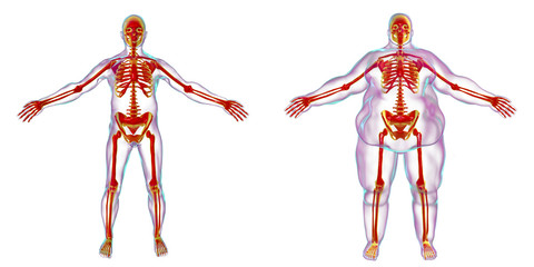 x-ray of skeleton inside obese body
